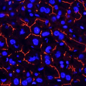 CEACAM-1/CD66a was detected in perfusion fixed frozen sections of mouse liver using Rat Anti-Mouse CEACAM-1/CD66a Monoclonal Antibody (Catalog # MAB6480) at 25 µg/mL overnight at 4 °C. Tissue was stained using the NorthernLights™ 557-conjugated Anti-Rat IgG Secondary Antibody (red; Catalog # NL013) and counterstained with DAPI (blue). Specific staining was localized to bile canaliculi. View our protocol for Fluorescent IHC Staining of Frozen Tissue Sections.