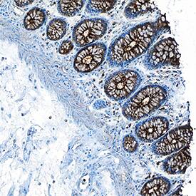 CEACAM-1/CD66a was detected in immersion fixed paraffin-embedded sections of human colon tissue using Goat Anti-Human CEACAM-1/CD66a Antigen Affinity-purified Polyclonal Antibody (Catalog # AF2244) at 5 µg/mL overnight at 4 °C. Tissue was stained using the Anti-Goat HRP-DAB Cell & Tissue Staining Kit (brown; Catalog # CTS008) and counterstained with hematoxylin (blue). Specific staining was localized to plasma membrane in glandular epithelial cells. View our protocol for Chromogenic IHC Staining of Paraffin-embedded Tissue Sections.