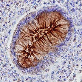 Immunohistochemistry CEACAM5/CD66e Antibody (487609) [Unconjugated]
