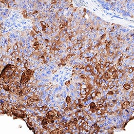 Immunohistochemistry CEACAM7 Antibody [Unconjugated]