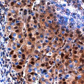 Immunohistochemistry CEBP alpha Antibody