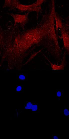 CEBP a was detected in immersion fixed human mesenchymal stem cells using Mouse Anti-Human CEBP a Monoclonal Antibody (Catalog # MAB7094) at 10 µg/mL for 3 hours at room temperature. Cells were stained using the NorthernLights™ 557-conjugated Anti-Mouse IgG Secondary Antibody (red, upper panel; Catalog # NL007) and counterstained with DAPI (blue, lower panel). Specific staining was localized to cytoplasm and nuclei. View our protocol for Fluorescent ICC Staining of Cells on Coverslips.