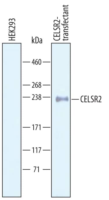 Western blot shows lysates of HEK293 human embryonic kidney cell line either mock transfected or transfected with human CELSR2. PVDF Membrane was probed with 1 µg/mL of Goat Anti-Human CELSR2 Antigen Affinity-purified Polyclonal Antibody (Catalog # AF6739) followed by HRP-conjugated Anti-Goat IgG Secondary Antibody (Catalog # HAF019). A specific band was detected for CELSR2 at approximately 240 kDa (as indicated). This experiment was conducted under reducing conditions and using Immunoblot Buffer Group 8.