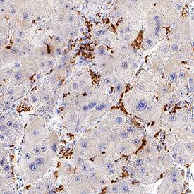 Immunohistochemistry CETP Antibody (995234) [Unconjugated]