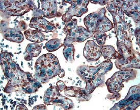 Immunohistochemistry CFTR Antibody (24-1) [Unconjugated] - C-terminus