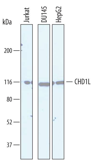 Western Blot CHD1L Antibody