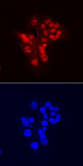 CHD7 was detected in immersion fixed HepG2 human hepatocellular carcinoma cell line using Mouse Anti-Human CHD7 Monoclonal Antibody (Catalog # MAB7350) at 10 µg/mL for 3 hours at room temperature. Cells were stained using the NorthernLights™ 557-conjugated Anti-Mouse IgG Secondary Antibody (red, upper panel; Catalog # NL007) and counterstained with DAPI (blue, lower panel). Specific staining was localized to nuclei. View our protocol for Fluorescent ICC Staining of Cells on Coverslips.