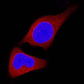 CHIP/STUB1 was detected in immersion fixed HeLa human cervical epithelial carcinoma cell line using Goat Anti-Human CHIP/STUB1 Antigen Affinity-purified Polyclonal Antibody (Catalog # AF4685) at 25 µg/mL for 3 hours at room temperature. Cells were stained using the NorthernLights™ 557-conjugated Anti-Goat IgG Secondary Antibody (red; Catalog # NL001) and counterstained with DAPI (blue). Specific staining was localized to cytoplasm and nuclei. View our protocol for Fluorescent ICC Staining of Cells on Coverslips.
