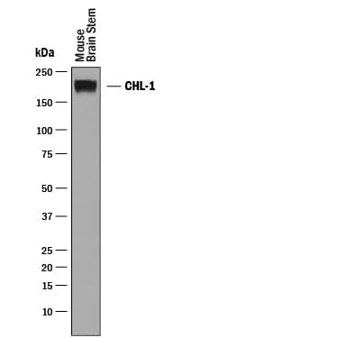 Western Blot CHL-1/L1CAM-2 Antibody [Unconjugated]
