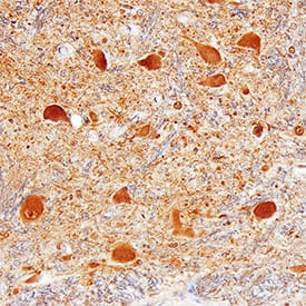 CHMP2B was detected in immersion fixed paraffin-embedded sections of human brain (medulla) using Sheep Anti-Human/Mouse/Rat CHMP2B Antigen Affinity-purified Polyclonal Antibody (Catalog # AF7509) at 3 µg/mL overnight at 4 °C. Tissue was stained using the Anti-Sheep HRP-DAB Cell & Tissue Staining Kit (brown; Catalog # CTS019) and counterstained with hematoxylin (blue). Specific staining was localized to neuronal cell bodies. View our protocol for Fluorescent ICC Staining of Cells on Coverslips.