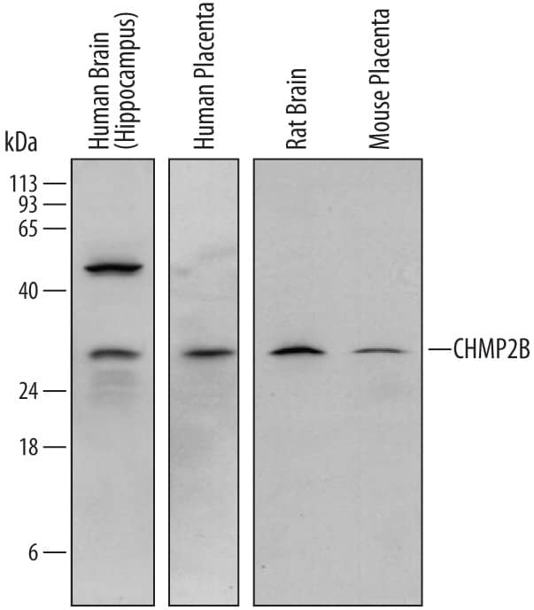 Western blot shows lysates of human brain (hippocampus) tissue, human placenta tissue, rat brain tissue, and mouse placenta tissue. PVDF membrane was probed with 1 µg/mL of Sheep Anti-Human/Mouse/Rat CHMP2B Antigen Affinity-purified Polyclonal Antibody (Catalog # AF7509) followed by HRP-conjugated Anti-Sheep IgG Secondary Antibody (Catalog # HAF016). A specific band was detected for CHMP2B at approximately 30 kDa (as indicated). This experiment was conducted under reducing conditions and using Immunoblot Buffer Group 1.