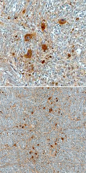 Immunohistochemistry CHMP2B Antibody (791521) [Unconjugated]
