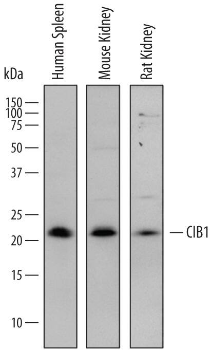 Western blot shows lysates of human spleen tissue, mouse kidney tissue, and rat kidney tissue. PVDF membrane was probed with 1 µg/mL of Sheep Anti-Human/Mouse/Rat CIB1 Antigen Affinity-purified Polyclonal Antibody (Catalog # AF7557) followed by HRP-conjugated Anti-Sheep IgG Secondary Antibody (Catalog # HAF016). A specific band was detected for CIB1 at approximately 22 kDa (as indicated). This experiment was conducted under reducing conditions and using Immunoblot Buffer Group 1.