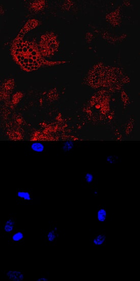 Immunocytochemistry CIDEC Antibody