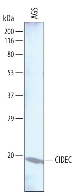 Western Blot CIDEC Antibody