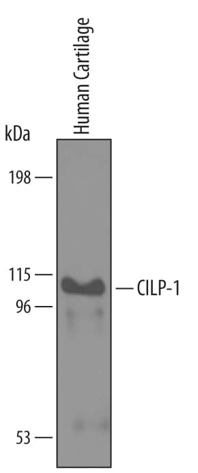 Western Blot CILP-1 Antibody [Unconjugated]