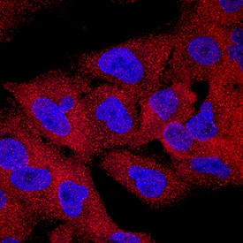CIN85/SH3KBP1 was detected in immersion fixed A549 human lung carcinoma cell line using Mouse Anti-Human CIN85/SH3KBP1 Monoclonal Antibody (Catalog # MAB88771) at 10 µg/mL for 3 hours at room temperature. Cells were stained using the NorthernLights™ 557-conjugated Anti-Mouse IgG Secondary Antibody (red; Catalog # NL007) and counterstained with DAPI (blue). Specific staining was localized to cytoplasm. View our protocol for Fluorescent ICC Staining of Cells on Coverslips.