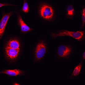 CKAP4/p63 was detected in immersion fixed HeLa human cervical epithelial carcinoma cell line using Sheep Anti-Human CKAP4/p63 Antigen Affinity-purified Polyclonal Antibody (Catalog # AF7355) at 10 µg/mL for 3 hours at room temperature. Cells were stained using the NorthernLights™ 557-conjugated Anti-Sheep IgG Secondary Antibody (red; NL010) and counterstained with DAPI (blue). Specific staining was localized to cytoplasm. View our protocol for Fluorescent ICC Staining of Cells on Coverslips.