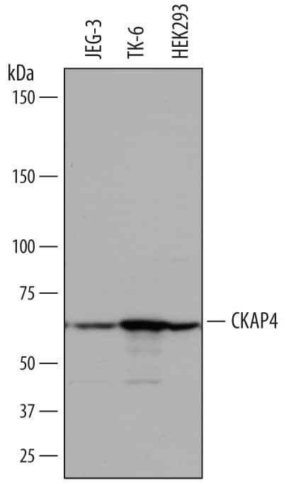 Western Blot CKAP4/p63 Antibody [Unconjugated]