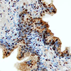 Immunohistochemistry CLC Antibody (138815) [Unconjugated]