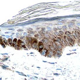 CLEC-2A was detected in immersion fixed paraffin-embedded sections of human skin using Mouse Anti-Human CLEC-2A Antigen Affinity-purified Monoclonal Antibody (Catalog # MAB72191) at 15 µg/mL overnight at 4 °C. Before incubation with the primary antibody, tissue was subjected to heat-induced epitope retrieval using Antigen Retrieval Reagent-Basic (Catalog # CTS013). Tissue was stained using the Anti-Mouse HRP-DAB Cell & Tissue Staining Kit (brown; Catalog # CTS002) and counterstained with hematoxylin (blue). Specific staining was localized to cytoplasm in keratinocytes. View our protocol for Chromogenic IHC Staining of Paraffin-embedded Tissue Sections.