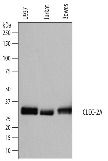 Western blot shows lysates of U937 human histiocytic lymphoma cell line, Jurkat human acute T cell leukemia cell line, and Bowes human melanoma cell line. PVDF membrane was probed with 0.5 µg/mL of Mouse Anti-Human CLEC-2A Antigen Affinity-purified Monoclonal Antibody (Catalog # MAB72191) followed by HRP-conjugated Anti-Mouse IgG Secondary Antibody (Catalog # HAF007). A specific band was detected for CLEC-2A at approximately 32 kDa (as indicated). This experiment was conducted under reducing conditions and using Immunoblot Buffer Group 1.