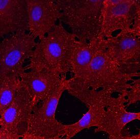 CLEC14A was detected in immersion fixed HUVEC human umbilical vein endothelial cells using Sheep Anti-Human CLEC14A Antigen Affinity-purified Polyclonal Antibody (Catalog # AF4968) at 10 µg/mL for 3 hours at room temperature. Cells were stained using the NorthernLights™ 557-conjugated Anti-Sheep IgG Secondary Antibody (red; Catalog # NL010) and counterstained with DAPI (blue). Specific staining was localized to cell surfaces and cytoplasm. View our protocol for Fluorescent ICC Staining of Cells on Coverslips.