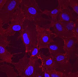 CLEC14A was detected in immersion fixed HUVEC human umbilical vein endothelial cells using Mouse Anti-Human CLEC14A Monoclonal Antibody (Catalog # MAB7436) at 10 µg/mL for 3 hours at room temperature. Cells were stained using the NorthernLights™ 557-conjugated Anti-Mouse IgG Secondary Antibody (red; Catalog # NL007) and counterstained with DAPI (blue). Specific staining was localized to plasma membranes and cytoplasm. View our protocol for Fluorescent ICC Staining of Cells on Coverslips.