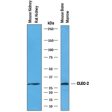 Western Blot CLEC-2/CLEC-1B Antibody [Unconjugated]