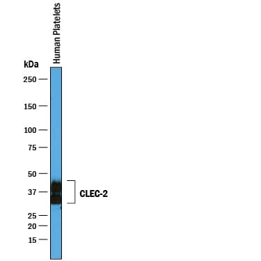 Western Blot CLEC-2/CLEC-1B Antibody [Unconjugated]