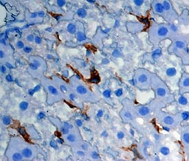 CLEC4F/CLECSF13 was detected in perfusion fixed frozen sections of mouse liver using Goat Anti-Mouse CLEC4F/CLECSF13 Antigen Affinity-purified Polyclonal Antibody (Catalog # AF2784) at 5 µg/mL overnight at 4 °C. Tissue was stained using the Anti-Goat HRP-DAB Cell & Tissue Staining Kit (brown; Catalog # <a class=