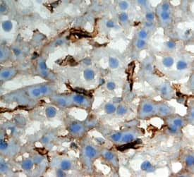 CLEC4F/CLECSF13 was detected in perfusion fixed frozen sections of mouse liver using Rat Anti-Mouse CLEC4F/CLECSF13 Monoclonal Antibody (Catalog # MAB2784) at 5 µg/mL overnight at 4 °C. Tissue was stained using the Anti-Rat HRP-DAB Cell & Tissue Staining Kit (brown; Catalog # <a class=
