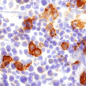 CLEC9a was detected in perfusion fixed frozen sections of mouse spleen using Sheep Anti-Mouse CLEC9a Antigen Affinity-purified Polyclonal Antibody (Catalog # AF6776) at 1.7 µg/mL overnight at 4 °C. Tissue was stained using the Anti-Sheep HRP-DAB Cell & Tissue Staining Kit (brown; Catalog # CTS019) and counterstained with hematoxylin (blue). Specific staining was localized to dendritic cells. View our protocol for Chromogenic IHC Staining of Frozen Tissue Sections.