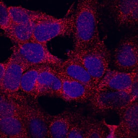 Immunocytochemistry CLP24/TMEM204 Antibody (652424)