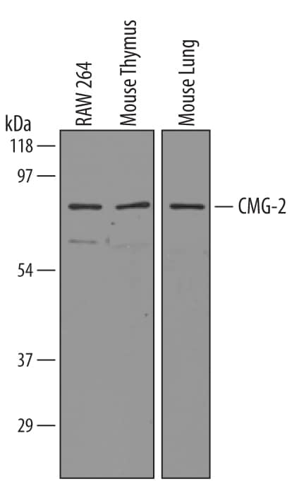 Western blot shows lysates of RAW 264.7 mouse monocyte/macrophage cell line, mouse thymus tissue, and mouse lung tissue. PVDF membrane was probed with 1 µg/mL of Mouse CMG-2/ANTXR2 Antigen Affinity-purified Polyclonal Antibody (Catalog # AF3636) followed by HRP-conjugated Anti-Goat IgG Secondary Antibody (Catalog # HAF019). A specific band was detected for CMG-2/ANTXR2 at approximately 55-65 kDa (as indicated). This experiment was conducted under reducing conditions and using Immunoblot Buffer Group 8.