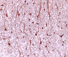 Immunohistochemistry CNTF Antibody [Unconjugated]