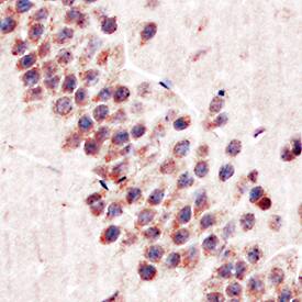Immunohistochemistry CNTF Antibody [Unconjugated]