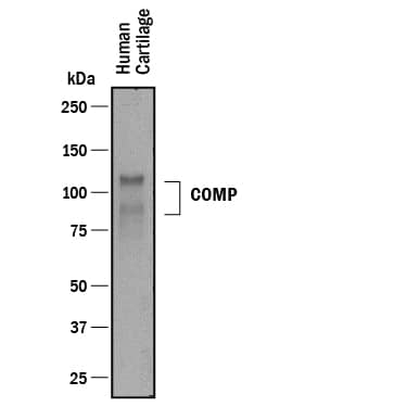 Western blot shows lysates of human cartilage tissue. PVDF membrane was probed with 0.05 µg/mL of Goat Anti-Human COMP/Thrombospondin-5 Antigen Affinity-purified Polyclonal Antibody (Catalog # AF3134) followed by HRP-conjugated Anti-Goat IgG Secondary Antibody (Catalog # HAF017). Specific bands were detected for COMP/Thrombospondin-5 at approximately 90 and 110 kDa (as indicated). This experiment was conducted under reducing conditions and using Immunoblot Buffer Group 1.