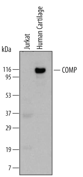 Western blot shows lysates of human cartilage tissue. PVDF membrane was probed with 2 µg/mL of Human COMP/Thrombospondin-5 Monoclonal Antibody (Catalog # MAB31341) followed by HRP-conjugated Anti-Mouse IgG Secondary Antibody (Catalog # HAF007). This experiment was conducted under reducing conditions and using Immunoblot Buffer Group 1.