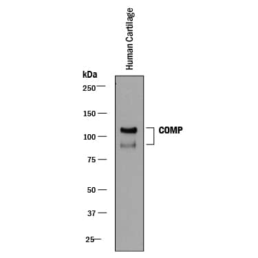 Western blot shows lysates of human cartilage tissue. PVDF membrane was probed with 0.05 µg/mL of Mouse Anti-Human COMP/Thrombospondin-5 Monoclonal Antibody (Catalog # MAB3134) followed by HRP-conjugated Anti-Mouse IgG Secondary Antibody (Catalog # HAF018). Specific bands were detected for COMP/Thrombospondin-5 at approximately 90 and 110 kDa (as indicated). This experiment was conducted under reducing conditions and using Immunoblot Buffer Group 1.