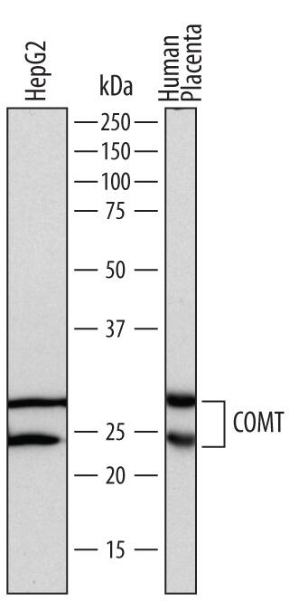 Western blot shows lysates of HepG2 human hepatocellular carcinoma cell line and human placenta tissue. PVDF membrane was probed with 0.1 µg/mL of Sheep Anti-Human COMT Antigen Affinity-purified Polyclonal Antibody (Catalog # AF7386) followed by HRP-conjugated Anti-Sheep IgG Secondary Antibody (Catalog # HAF016). Specific bands were detected for COMT at approximately 25 and 30 kDa (as indicated). This experiment was conducted under reducing conditions and using Immunoblot Buffer Group 1.