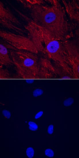 CTRP3/C1qTNF3/CORS26 was detected in immersion fixed human mesenchymal stem cells differentiated (upper panel) or not (lower panel) into adipocytes using Sheep Anti-Human CTRP3/C1qTNF3/CORS26 Antigen Affinity-purified Polyclonal Antibody (Catalog # AF7925) at 10 µg/mL for 3 hours at room temperature. Cells were stained using the NorthernLights™ 557-conjugated Anti-Sheep IgG Secondary Antibody (red; Catalog # NL010) and counterstained with DAPI (blue. Specific staining was localized to cytoplasm. View our protocol for Fluorescent ICC Staining of Cells on Coverslips.
