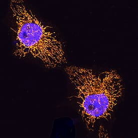 COX4-I1 was detected in immersion fixed HeLa human cervical epithelial carcinoma cell line using Goat Anti-Human/Mouse COX4-I1 Antigen Affinity-purified Polyclonal Antibody (Catalog # AF5814) at 5 µg/mL for 3 hours at room temperature. Cells were stained using the NorthernLights™ 557-conjugated Anti-Goat IgG Secondary Antibody (yellow; Catalog # NL001) and counterstained with DAPI (blue). Specific staining was localized to mitochondria. View our protocol for Fluorescent ICC Staining of Cells on Coverslips.