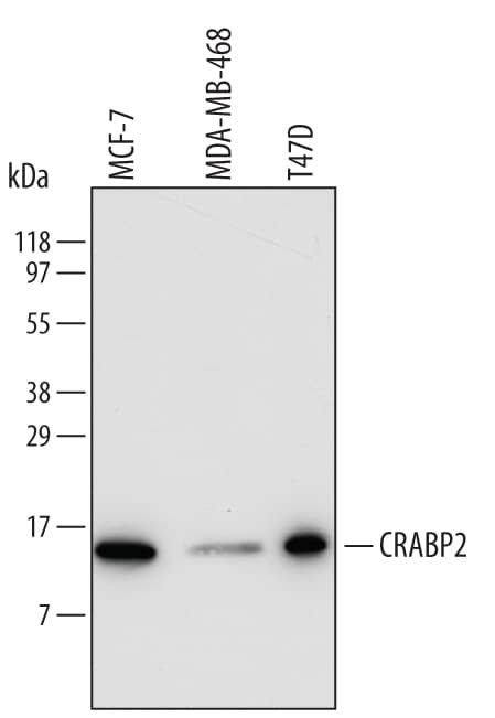 Western blot shows lysates of MCF-7 human breast cancer cell line, MDA-MB-468 human breast cancer cell line, and T47D human breast cancer cell line. PVDF membrane was probed with 0.5 µg/mL of Human CRABP2 Antigen Affinity-purified Polyclonal Antibody (Catalog # AF5740) followed by HRP-conjugated Anti-Goat IgG Secondary Antibody (Catalog # HAF109). A specific band was detected for CRABP2 at approximately 14 kDa (as indicated). This experiment was conducted under reducing conditions and using Immunoblot Buffer Group 1.