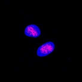 CREB was detected in immersion fixed MCF-7 human breast cancer cell line using Goat Anti-Human CREB Antigen Affinity-purified Polyclonal Antibody (Catalog # AF2989) at 5 µg/mL for 3 hours at room temperature. Cells were stained using the NorthernLights™ 557-conjugated Anti-Goat IgG Secondary Antibody (red; Catalog # NL001) and counterstained with DAPI (blue). Specific staining was localized to nuclei. View our protocol for Fluorescent ICC Staining of Cells on Coverslips.