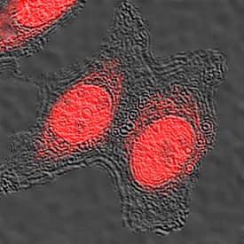 CREB was detected in immersion fixed MCF-7 human breast cancer cell line using Goat Anti-Human CREB Antigen Affinity-purified Polyclonal Antibody (Catalog # AF2989) at 0.5 µg/mL for 3 hours at room temperature. Cells were stained using the NorthernLights™ 557-conjugated Anti-Goat IgG Secondary Antibody (red; Catalog # NL001). Specific staining was localized to nuclei and cytoplasm. View our protocol for Fluorescent ICC Staining of Cells on Coverslips.
