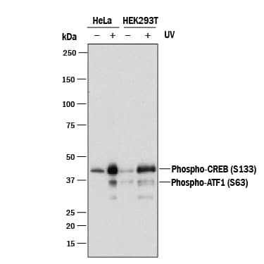 Western blot shows lysates of HeLa human cervical epithelial carcinoma cell line and HEK293T human embryonic kidney cell line untreated (-) or treated (+) with 20 mJ/cm2 ultraviolet light (UV) with a 30 minute recovery. PVDF membrane was probed with 0.5 µg/mL of Mouse Anti-Human Phospho-CREB (S133) Monoclonal Antibody (Catalog # MAB6906R) followed by HRP-conjugated Anti-Mouse IgG Secondary Antibody (Catalog # HAF018). A specific band was detected for Phospho-CREB (S133) at approximately 45 kDa (as indicated). This experiment was conducted under reducing conditions and using Immunoblot Buffer Group 1.