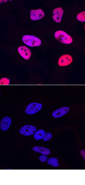 <b>Biological Strategies Validation. </b>CREB phosphorylated at A133 was detected in immersion fixed Hela human cervical epithelial carcinoma cells, unstimulated (lower panel) and stimulated (upper panel) with PMA, using Mouse Anti-Human Phospho-CREB (S133) Monoclonal Antibody (Catalog # MAB6906) at 10 µg/mL for 3 hours at room temperature. Cells were stained using the NorthernLights™ 557-conjugated Anti-Mouse IgG Secondary Antibody (red; Catalog # NL007) and counterstained with DAPI (blue). Specific staining was localized to nuclei. View our protocol for Fluorescent ICC Staining of Cells on Coverslips.