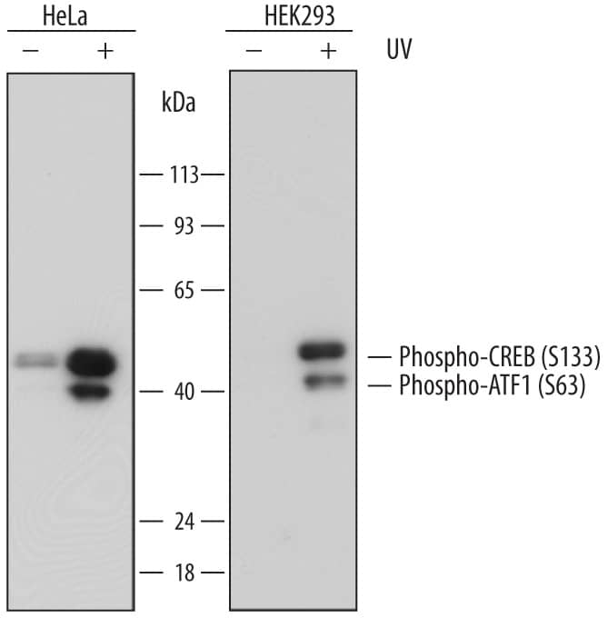 Western blot shows lysates of HeLa human cervical epithelial carcinoma cell line and HEK293 human embryonic kidney cell line untreated (-) or treated (+) with 20 mJ/cm2ultraviolet light (UV) with a 30 minute recovery. PVDF membrane was probed with 0.5 µg/mL of Mouse Anti-Human Phospho-CREB (S133) Monoclonal Antibody (Catalog # MAB6906) followed by HRP-conjugated Anti-Mouse IgG Secondary Antibody (Catalog # HAF007). A specific band was detected for Phospho-CREB (S133) at approximately 45 kDa (as indicated). This experiment was conducted under reducing conditions and using Immunoblot Buffer Group 1.