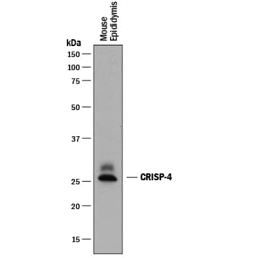 Western blot shows lysates of mouse epididymis tissue. PVDF membrane was probed with 0.2 µg/mL of Sheep Anti-Mouse CRISP-4 Antigen Affinity-purified Polyclonal Antibody (Catalog # AF5017) followed by HRP-conjugated Anti-Sheep IgG Secondary Antibody (Catalog # HAF016). Specific bands were detected for CRISP-4 at approximately 26-30 kDa (as indicated). This experiment was conducted under reducing conditions and using Immunoblot Buffer Group 1.